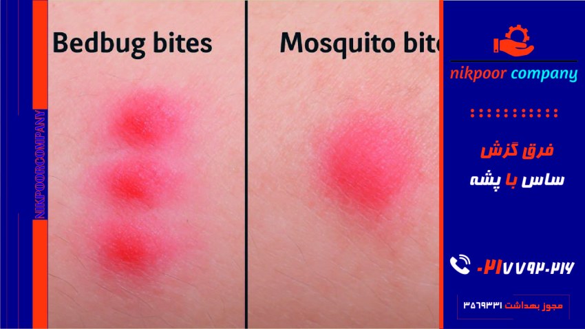 فرق گزش ساس با پشه