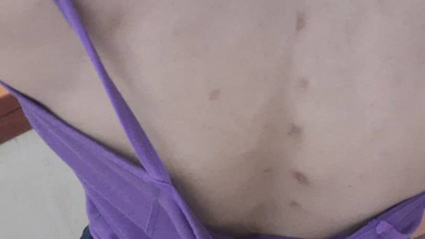 عکس گزش ساس