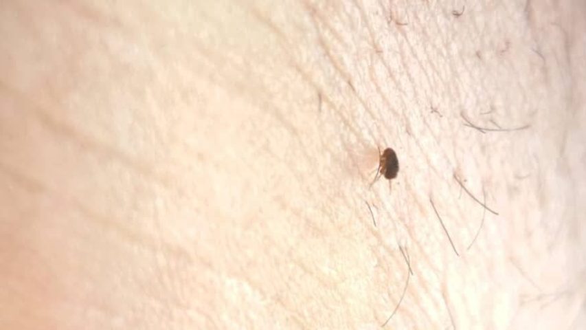 علائم گزش کک